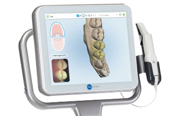 Digitale Kieferorthopädie ohne Abdruck mit unserem intraoralen 3D-Scanner