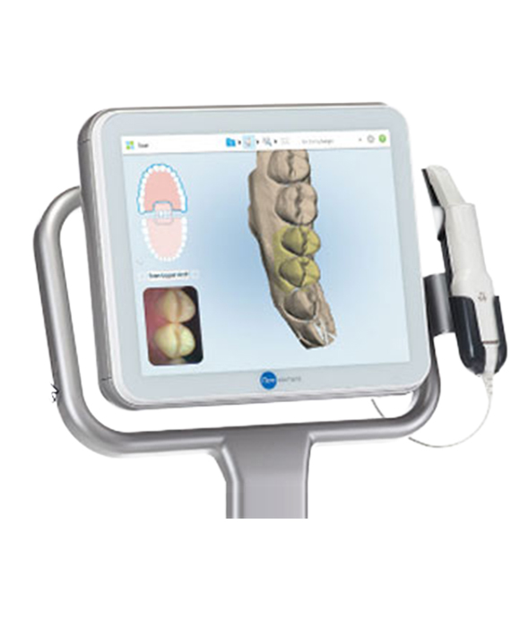UP610 Intraoralscanner | Hochpräzise, leichte & schnelle Scanlösung