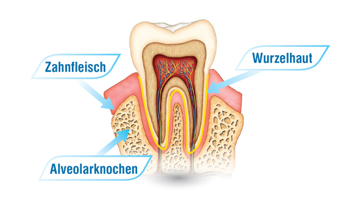 Mit AcceleDent® zu einer schnellen & bequemen Behandlung