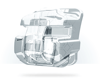 Clear Kermaik Brackets · Fachzahnärzte für Kieferorthopädie · Dr. Fricke & Dr. Ritschel