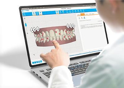 Invisalign ClinCheck Dr. Fricke & Ritschel Dortmund