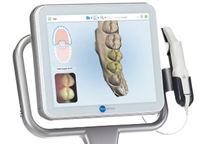 Der Kieferscanner - Itero Element Dr. Fricke & Ritschel Dortmund