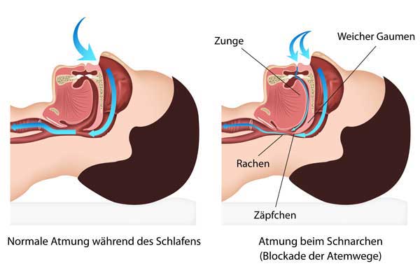 Schnarchtherapie · Fachzahnärzte für Kieferorthopädie · Dr. Fricke & Dr. Ritschel