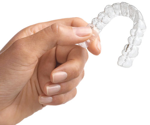 Invisalign Zahnkorrektur