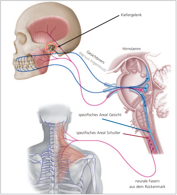 Verspannung der Hals-, Nacken- und Schultermuskulatur · Fachzahnärzte für Kieferorthopädie · Dr. Fricke & Dr. Ritschel